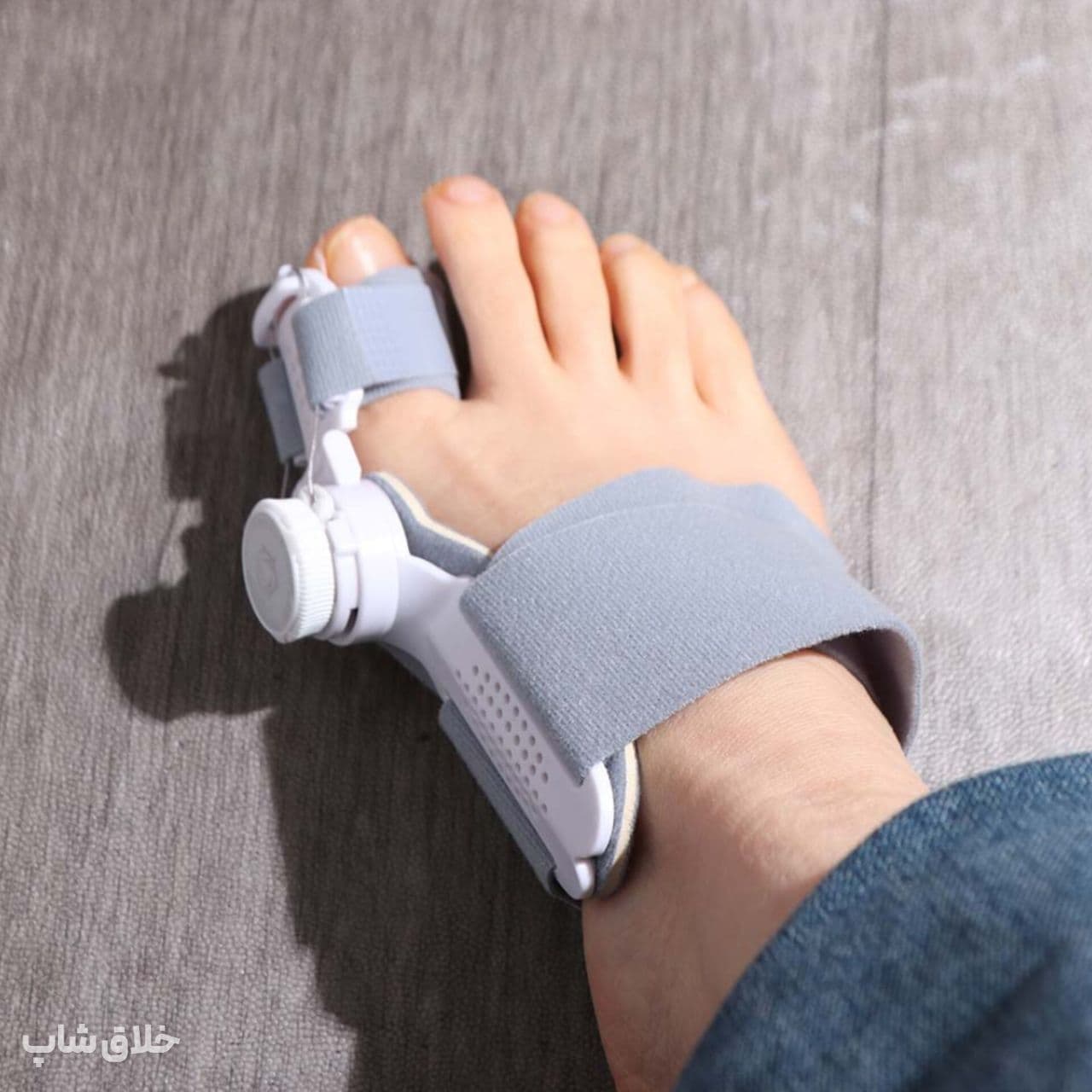 اصلاح انحراف شست پا-آتل انگشت پا درمان هالوکس والگوس — تصویر ۹