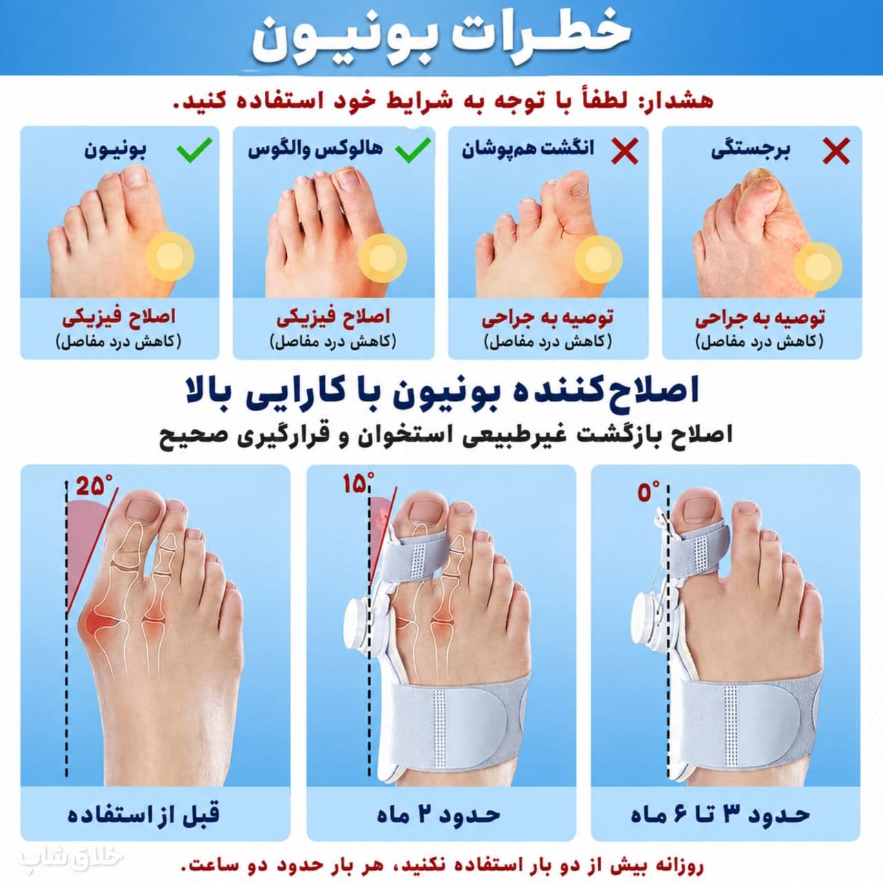 اصلاح انحراف شست پا-آتل انگشت پا درمان هالوکس والگوس — تصویر ۸