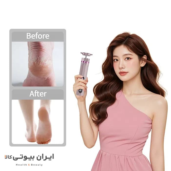 سنگ پا برقی آمبرمی مدل C255 — تصویر ۷
