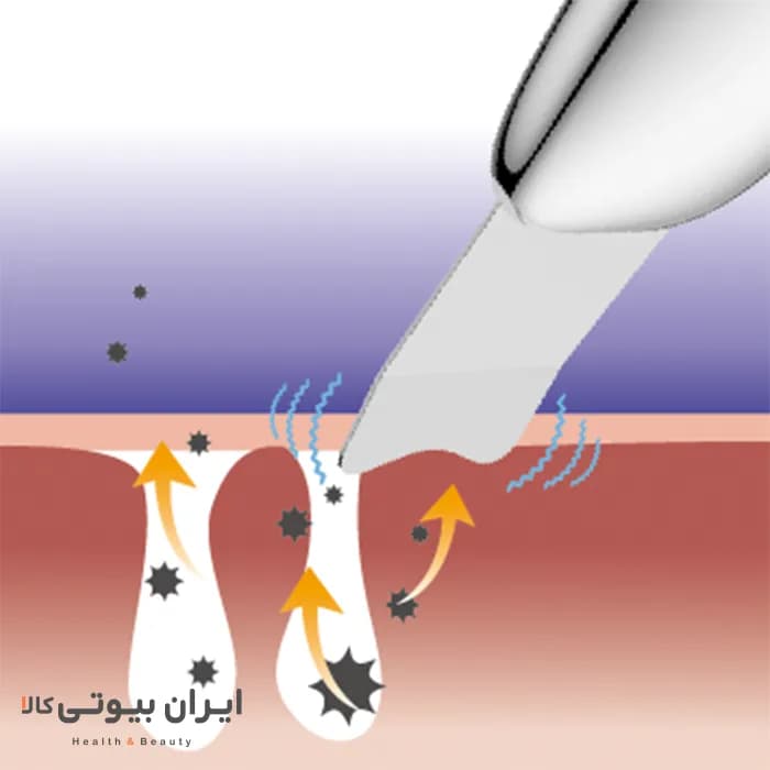 اتو صورت (درما اف) التراسونیک تاچ بیوتی مدلTB1769 — تصویر ۱۲