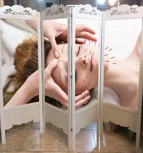 پاراوان پزشکی طب سوزنی — تصویر ۲