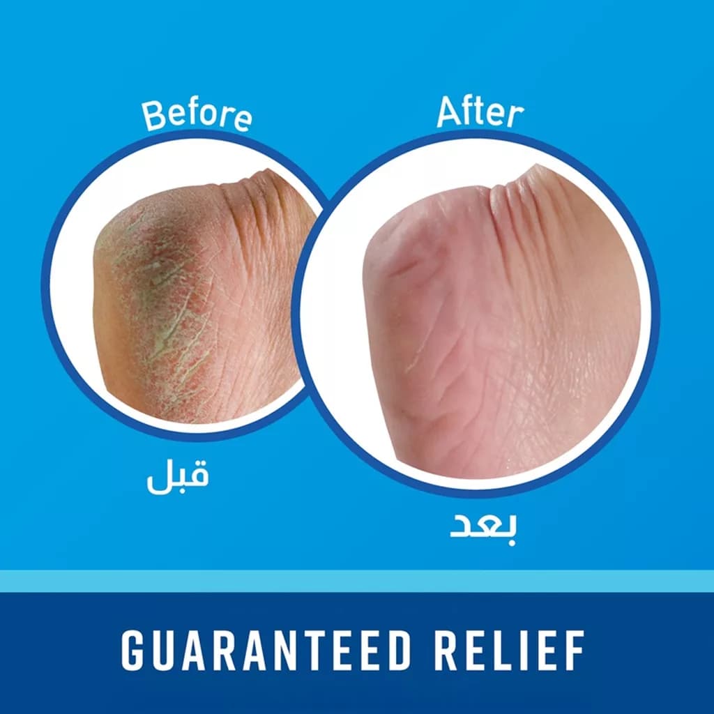 کرم آبرسان و ترمیمکننده ترک پای اوکیف درمان خشکی شدید ۸۵ گرم O’Keeffe’s Healthy Feet Foot Cream — تصویر ۱۲