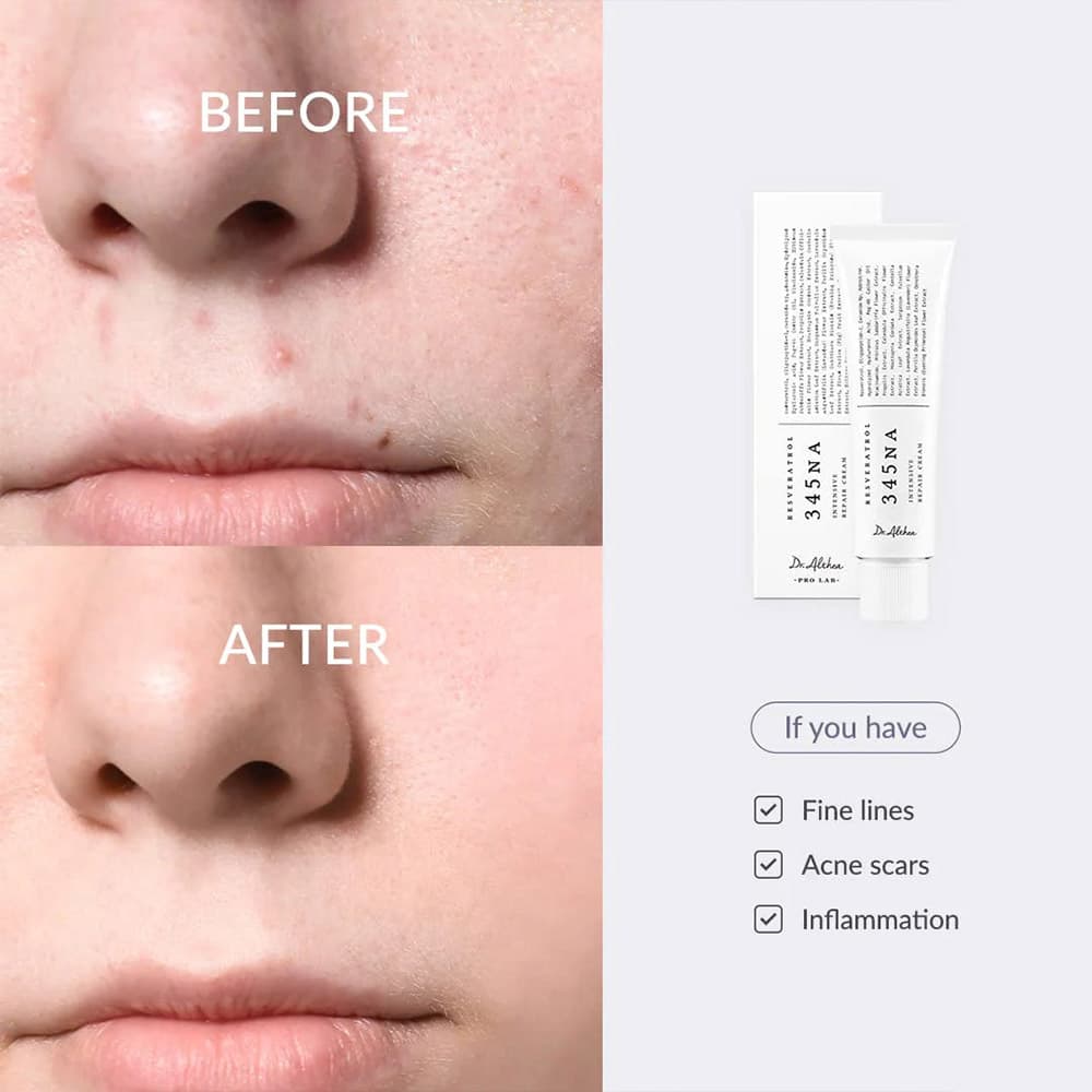 کرم ترمیم کننده دکتر التیا Dr. Althea 345 Relief Cream — تصویر ۸