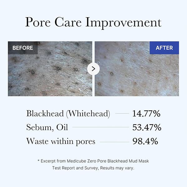 ماسک کنترل منافذ و جوش سر سیاه Zero Pore Blackhead مدی کیوب 100 میل — تصویر ۸