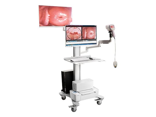 دستگاه کولپوسکوپی دیجیتال کرنل مدل KN-2200IH — تصویر ۲