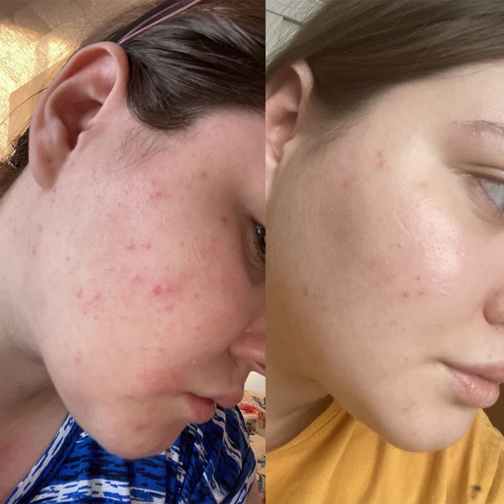 تونر لایه بردار و روشن کننده گلیکولیک اسید 7% اوردینری The Ordinary Glycolic Acid 7% Toning Solution 240ml — تصویر ۱۲
