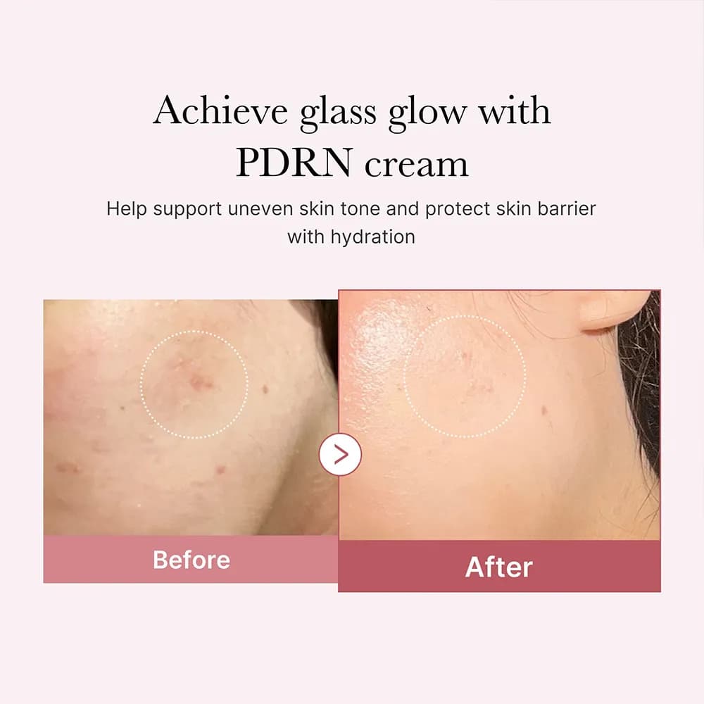 کرم مرطوب کننده هیالورونیک و PDRN مدی کیوب Medicube — تصویر ۹