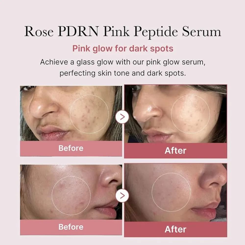 سرم صورتی پپتاید و PDRN مدی کیوب MEDICUBE PDRN PINK PEPTIDE SERUM — تصویر ۱۲