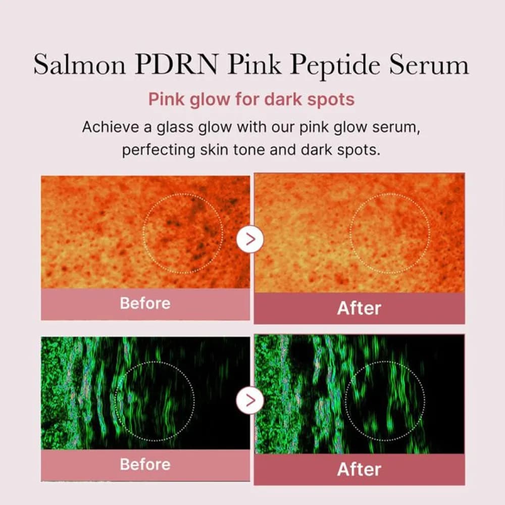 سرم صورتی پپتاید و PDRN مدی کیوب MEDICUBE PDRN PINK PEPTIDE SERUM — تصویر ۷