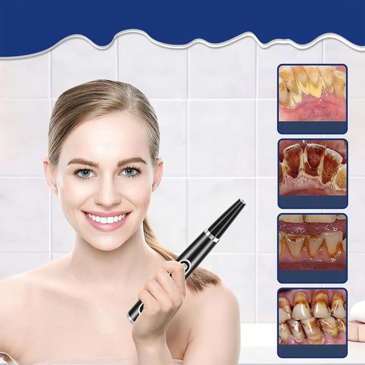 کیت جرم گیری(التراسونیک)دندان.لثه ازبین برنده زردی.سیاهی دندان/خوشبو شدن بوی دهان — تصویر ۲