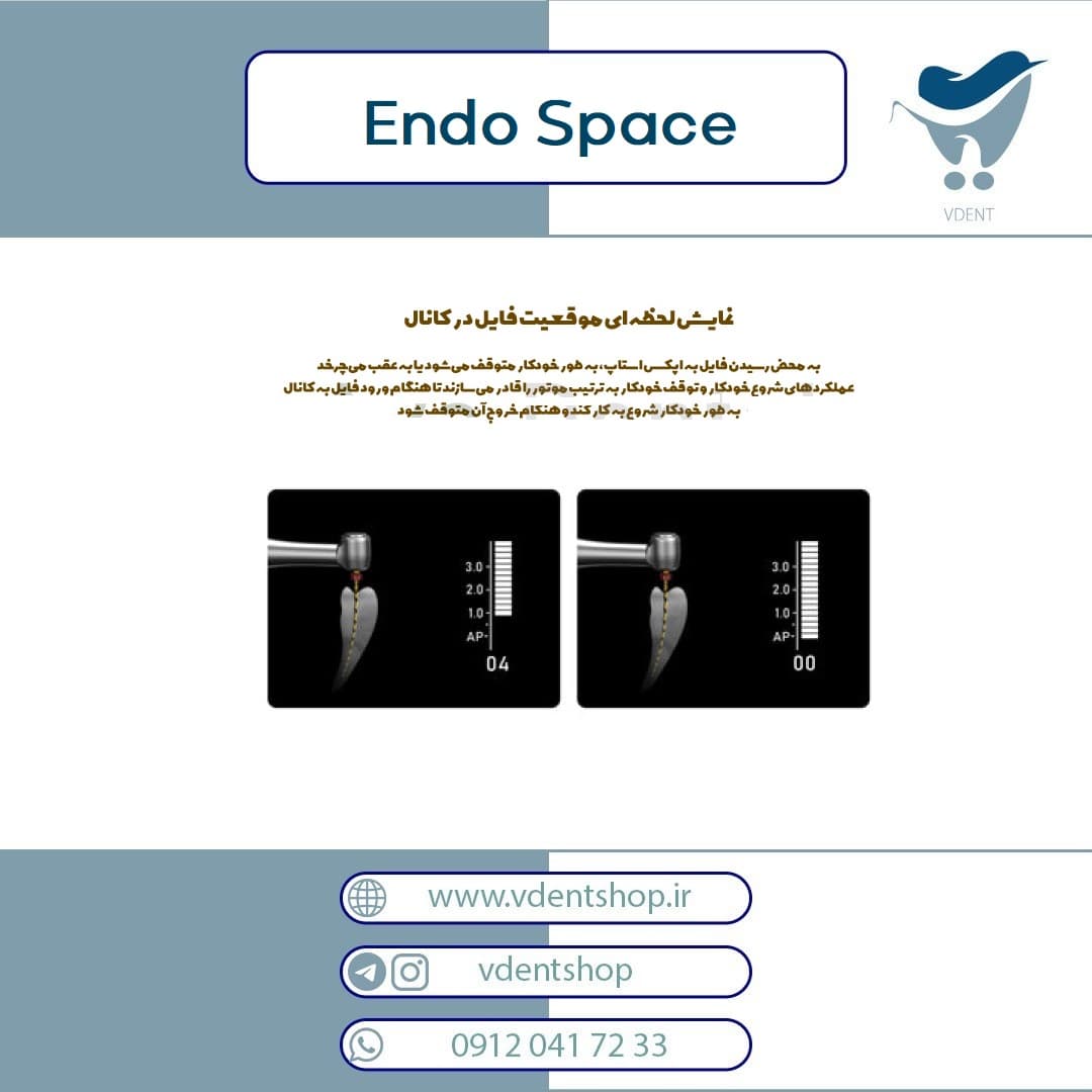 اپکس روتاری Woodpecker RTA مدل Endo Space — تصویر ۷