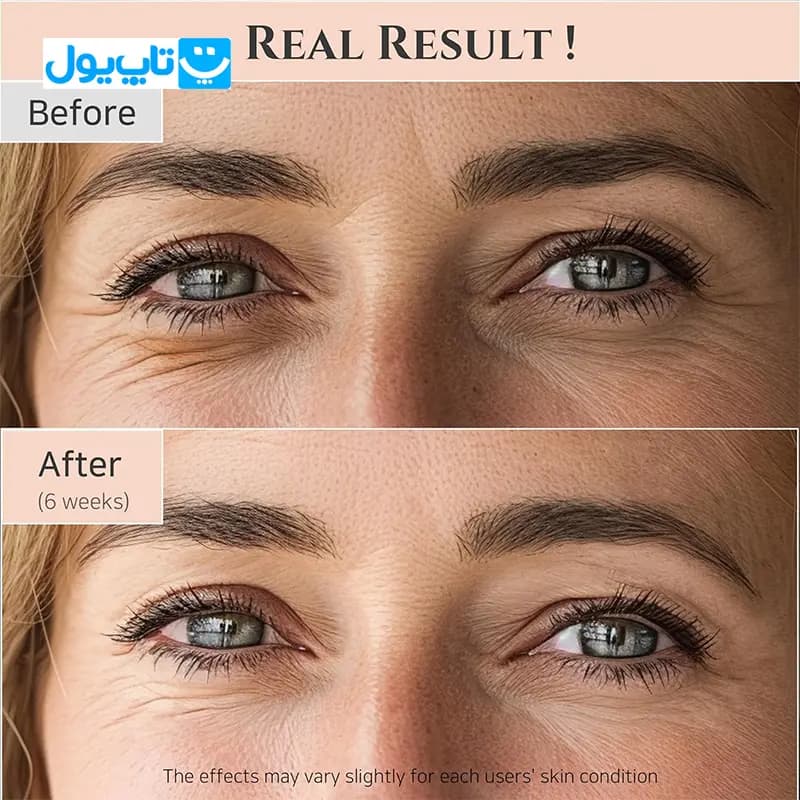 سرم دور چشم بیوتی آف جوسان beauty of joseon حاوی جینسینگ و رتینول حجم 30 میلی لیتر — تصویر ۷