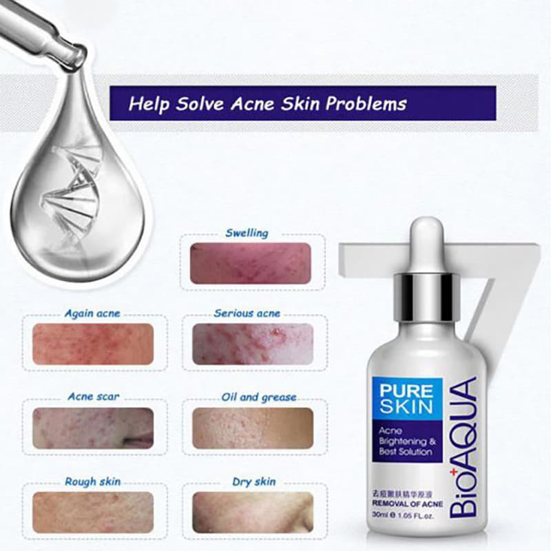 سرم آنتی آکنه بیوآکوا BioAqua — تصویر ۹
