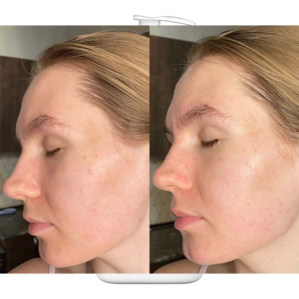 فوم شستشوی صورت سراوی مخصوص پوست نرمال تا چرب Cerave Foaming Cleanser For Normal To Oily Skin 87ml — تصویر ۶