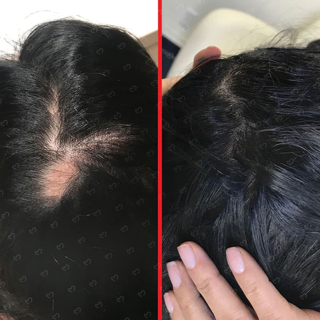 کپسول هیرتامین ضد ریزش و تقویت کننده مو بسته 30 عددی — تصویر ۱۱