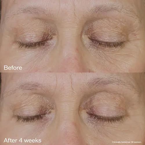 کرم دور چشم شیسیدو شاداب کننده و سفت کننده Vital Perfection — تصویر ۷