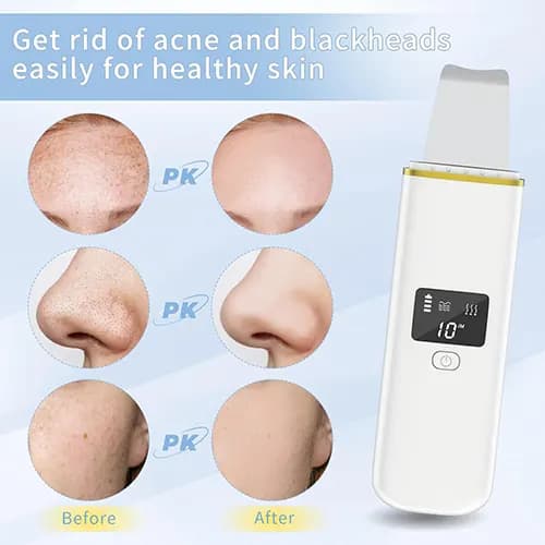 اتو صورت اولتراسونیک SKIN SCRUBBER — تصویر ۳