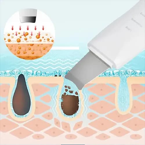 اتو صورت اولتراسونیک Shovel Skin Machine — تصویر ۱۱