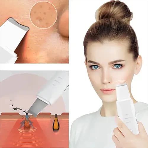 اتو صورت اولتراسونیک Shovel Skin Machine — تصویر ۷