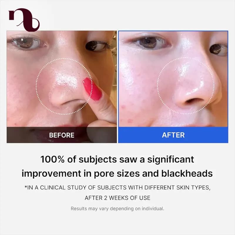 تونر کوچک کننده منافذ مدی کیوب 250 میل مدل Zero Pore Toner — تصویر ۶