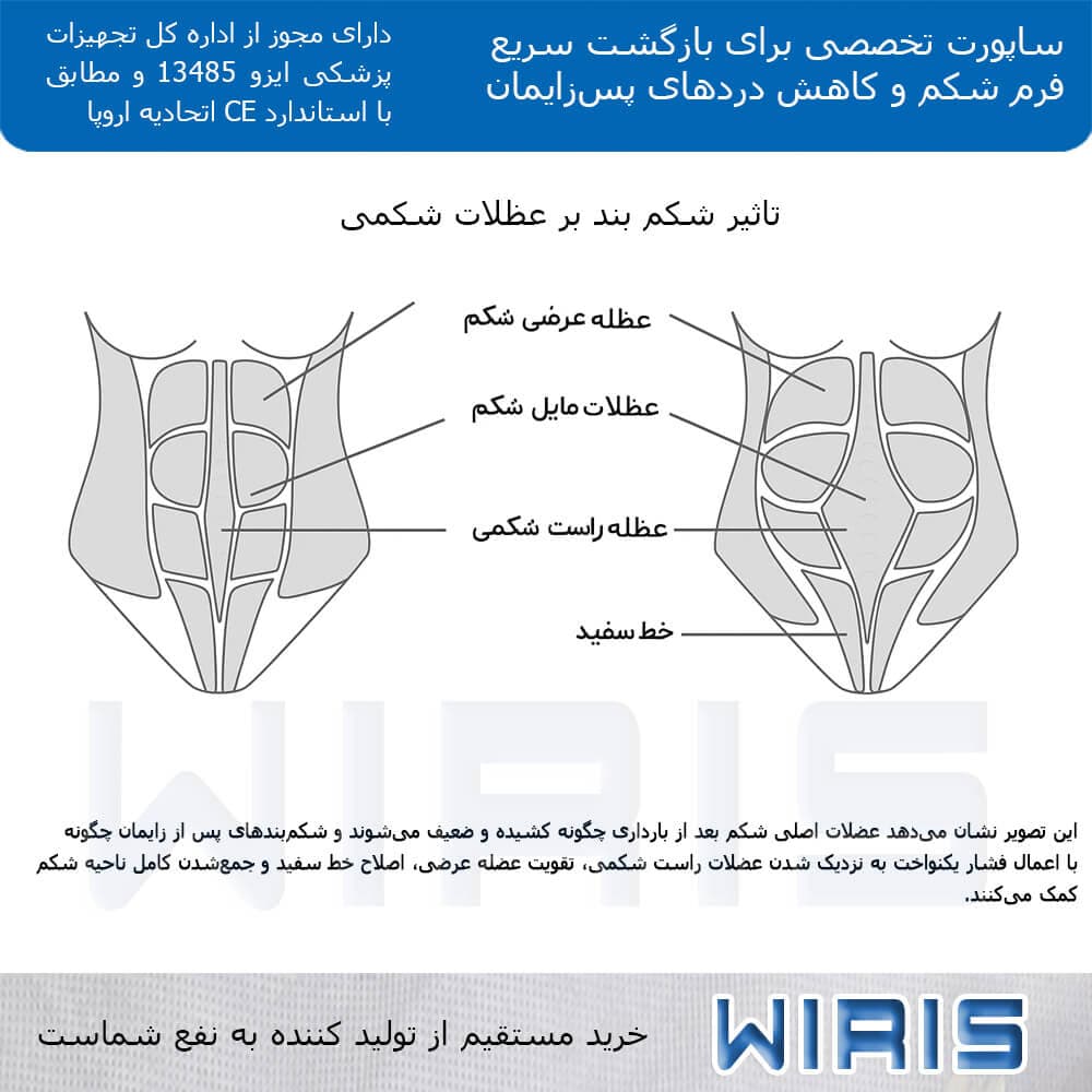 شکم بند بعداز زایمان ویریس — تصویر ۴
