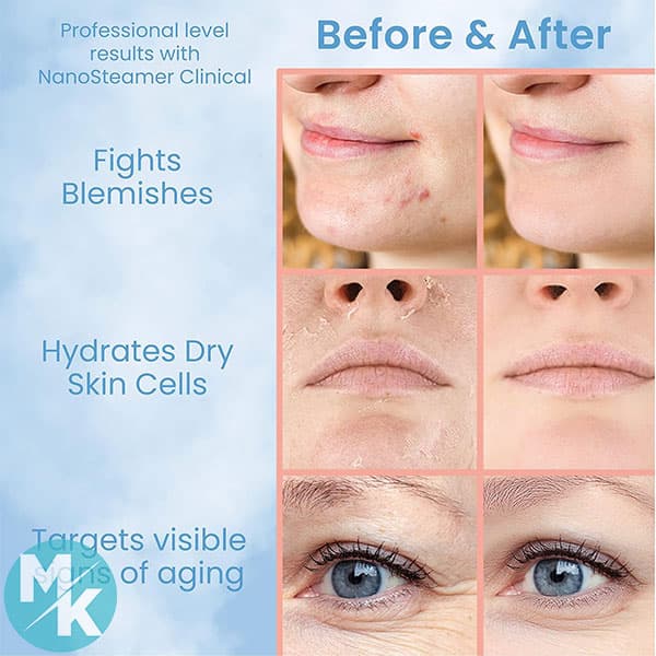 دستگاه بخور مخصوص پاکسازی صورت برند Pure Daily Care مدل PDCNC — تصویر ۴