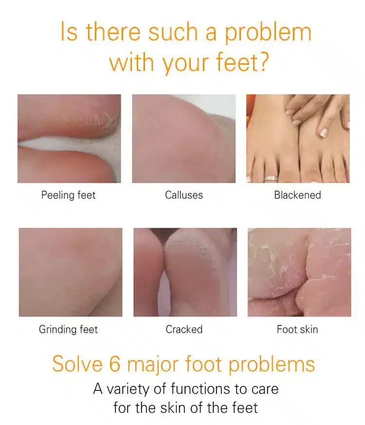 ماسک جورابی مغذی پا ویتامین سی استلین اورجینال مرطوب کننده 36 گرم ESTELIN Vitamin C Nourishing Foot Mask — تصویر ۴