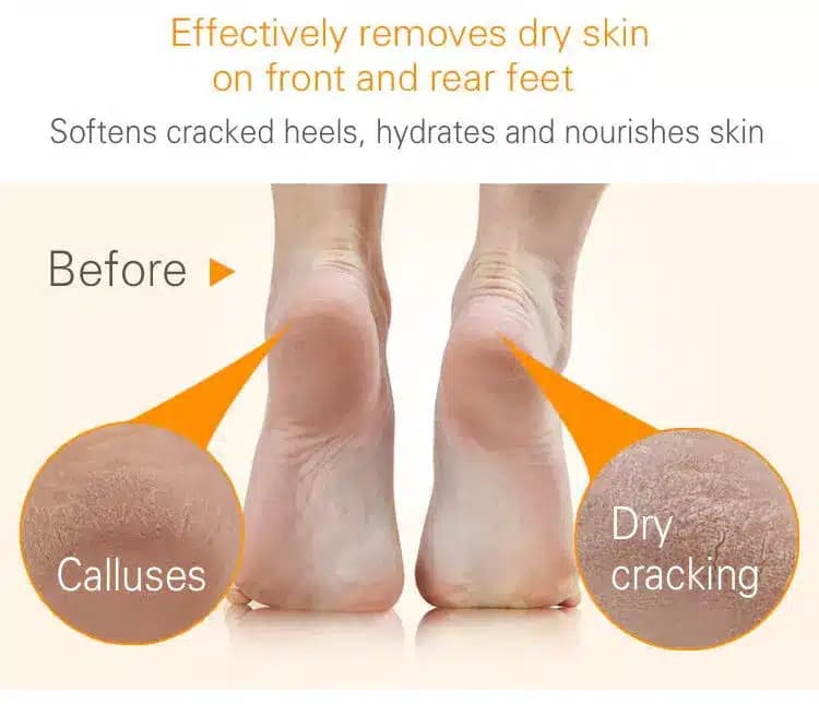 ماسک پا لایه بردار ویتامین سی استلین اورجینال 40گرم ESTELIN Vitamin C Exfoliating Foot Peel Mask — تصویر ۸