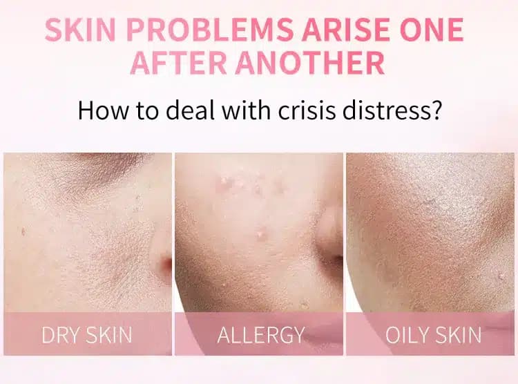 کرم شکوفه گیلاس استلین اورجینال 50گرم ESTELIN Cherry Blossoms Regeneration Cream — تصویر ۳