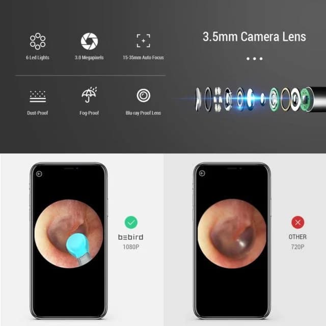 گوش پاک کن هوشمند شیائومی Xiaomi Bebird Smart Visual Ear Cleaning Rod M9 Pro — تصویر ۳