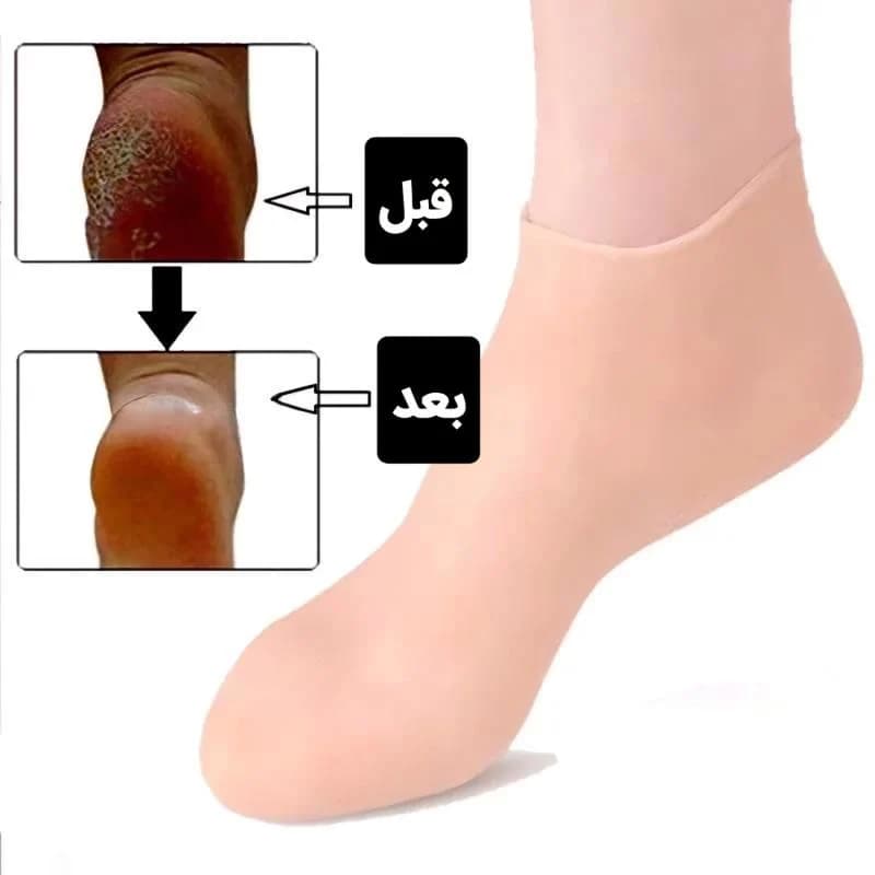 جوراب سیلیکونی محافظ پا — تصویر ۴