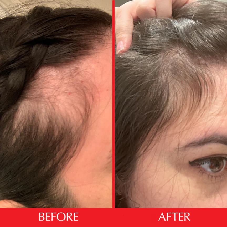 کپسول تقویت کننده مو Advanced Formula هیرتامین (خرید مستقیم از آمریکا) — تصویر ۱۲