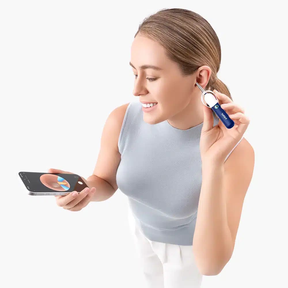 گوش پاک کن هوشمند بیبرد مدل Bebird EarSight Plus — تصویر ۶