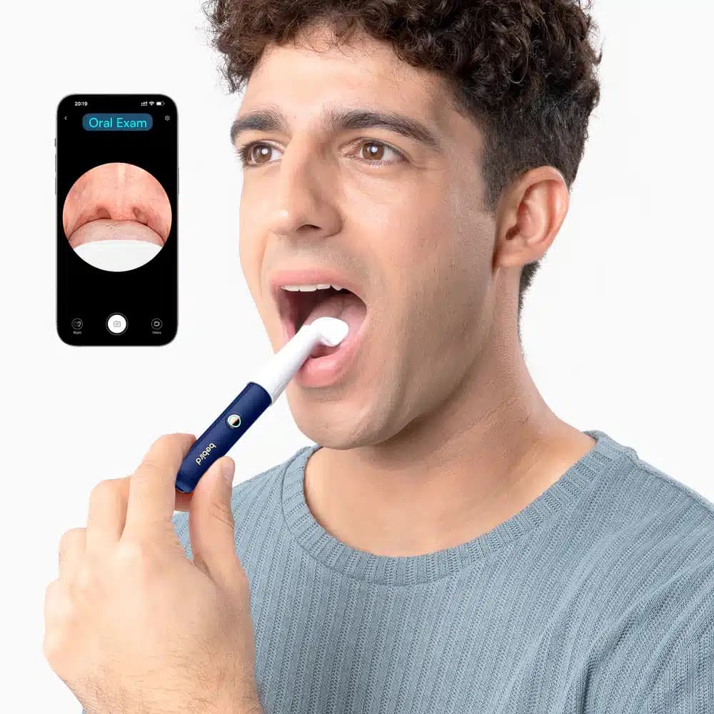 گوش پاک کن هوشمند بیبرد مدل Bebird EarSight Plus — تصویر ۸