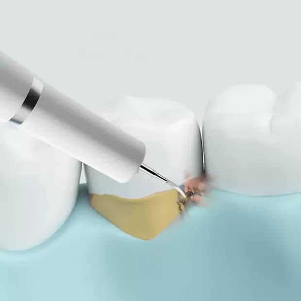 جرم گیر خانگی شیائومی مدل DR.BEI YC2 «اورجینال – ارسال 1 ساعت» — تصویر ۶