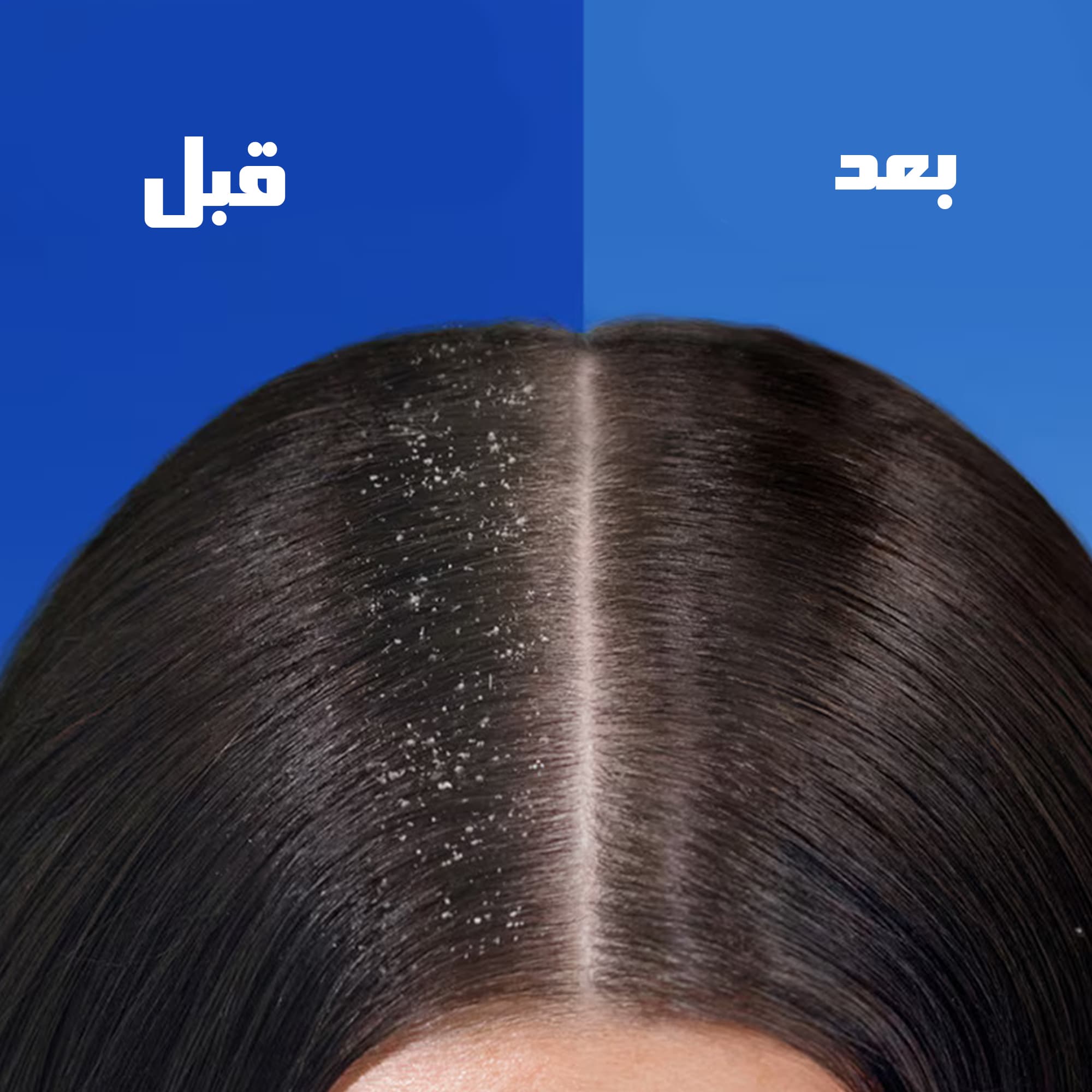 شامپو ضد شوره هد اند شولدرز مدل SHOULDERS EKSTRA HACIM — تصویر ۷