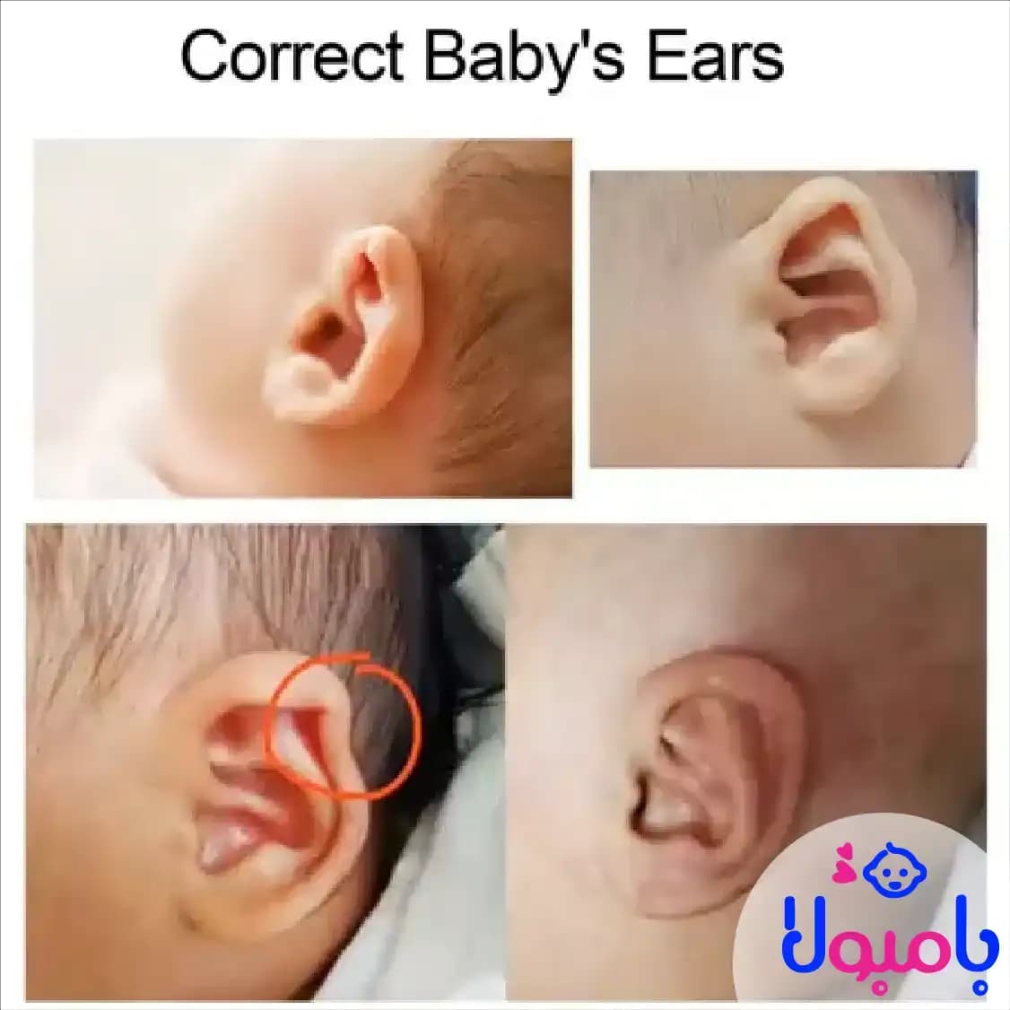 چسب اصلاح فرم گوش نوزاد 100*4 سانت AIKE — تصویر ۸