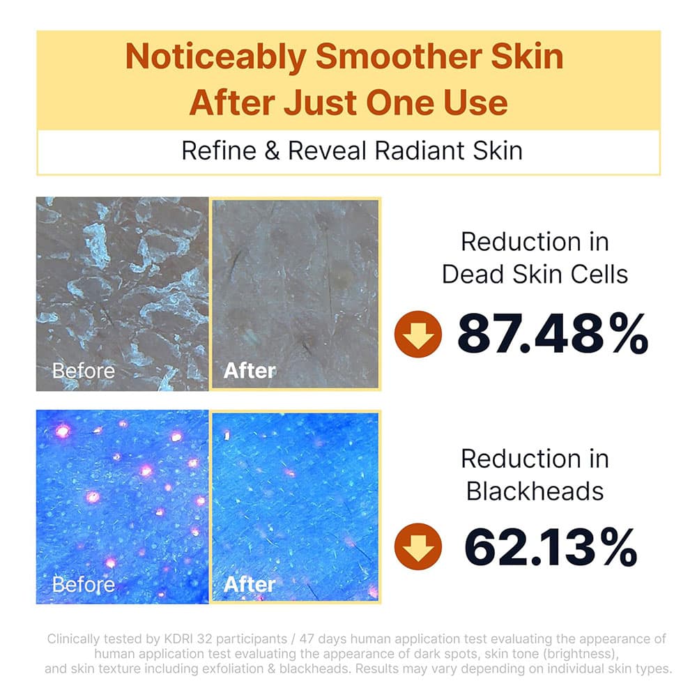 سرم روشن کننده پیل شات کوجیک اسید و نیاسینامید سانگ بون SUNGBOON EDITOR Kojic Acid Niacinamide Brightening Rice Peel Shot — تصویر ۱۲
