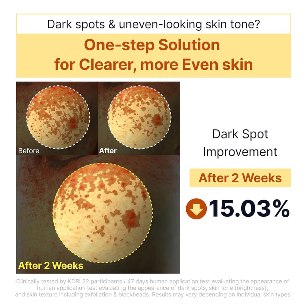سرم روشن کننده پیل شات کوجیک اسید و نیاسینامید سانگ بون SUNGBOON EDITOR Kojic Acid Niacinamide Brightening Rice Peel Shot — تصویر ۱۱