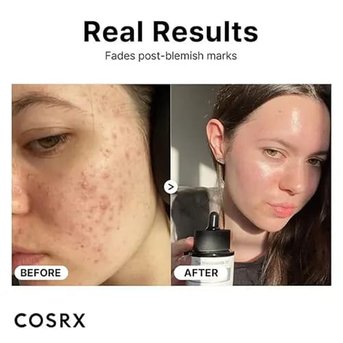 سرم نیاسینامید 15 کوزارکس Cosrx حجم 20 میلی‌لیتر — تصویر ۷