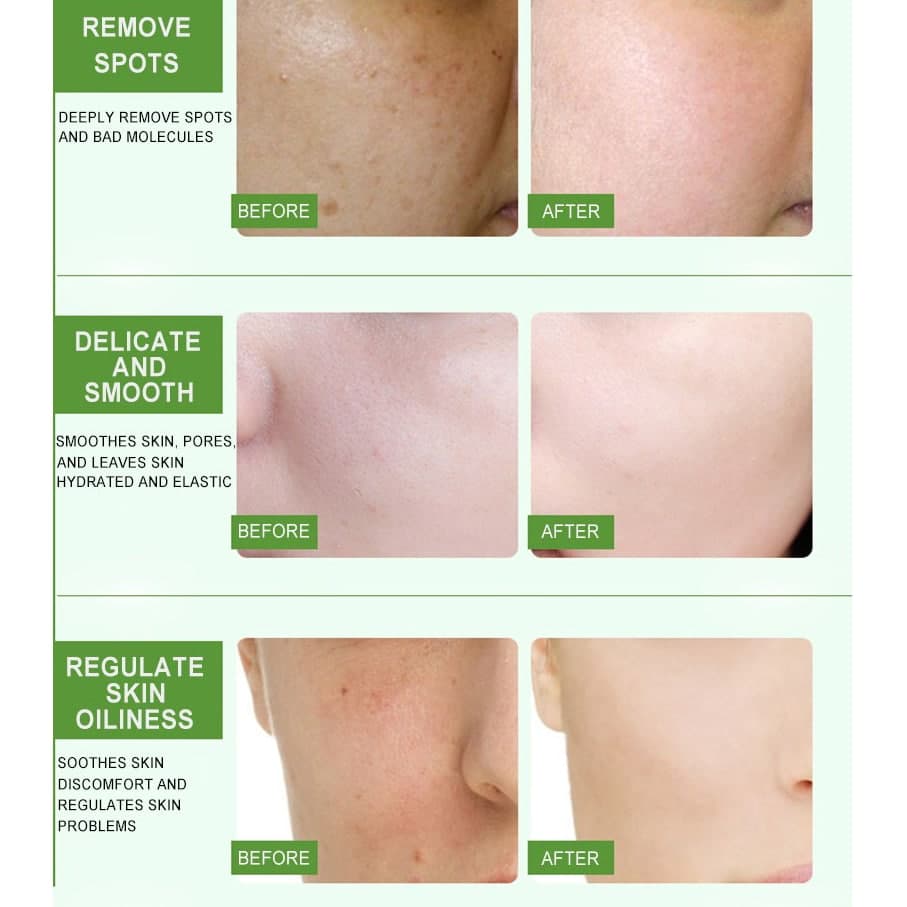 اسپری آبرسان آلوورا دکتر راشل اورجینال 160میل DR.RASHEL AloeVera soothing – moisture Spray — تصویر ۱۱