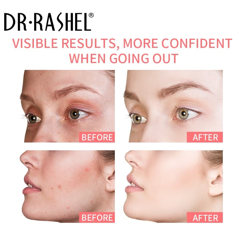 ماسک خاک رس استیکی شکوفه دکتر راشل سفیدکننده اورجینال 42گرم DR RASHEL Whitening Complex Pink Mineral Clay Stick — تصویر ۷