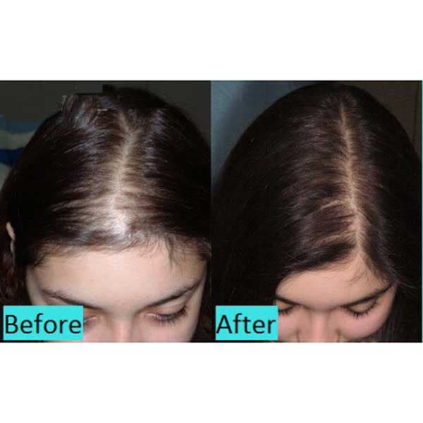 کوکتل درماهیل HL تقویت مو سر اصل کره جنوبی Dermaheal HL — تصویر ۱۰