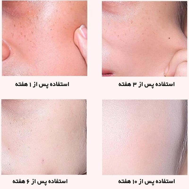 سرم پوست پرتقال خونی مرطوب کننده و مغزی IMAGES — تصویر ۸