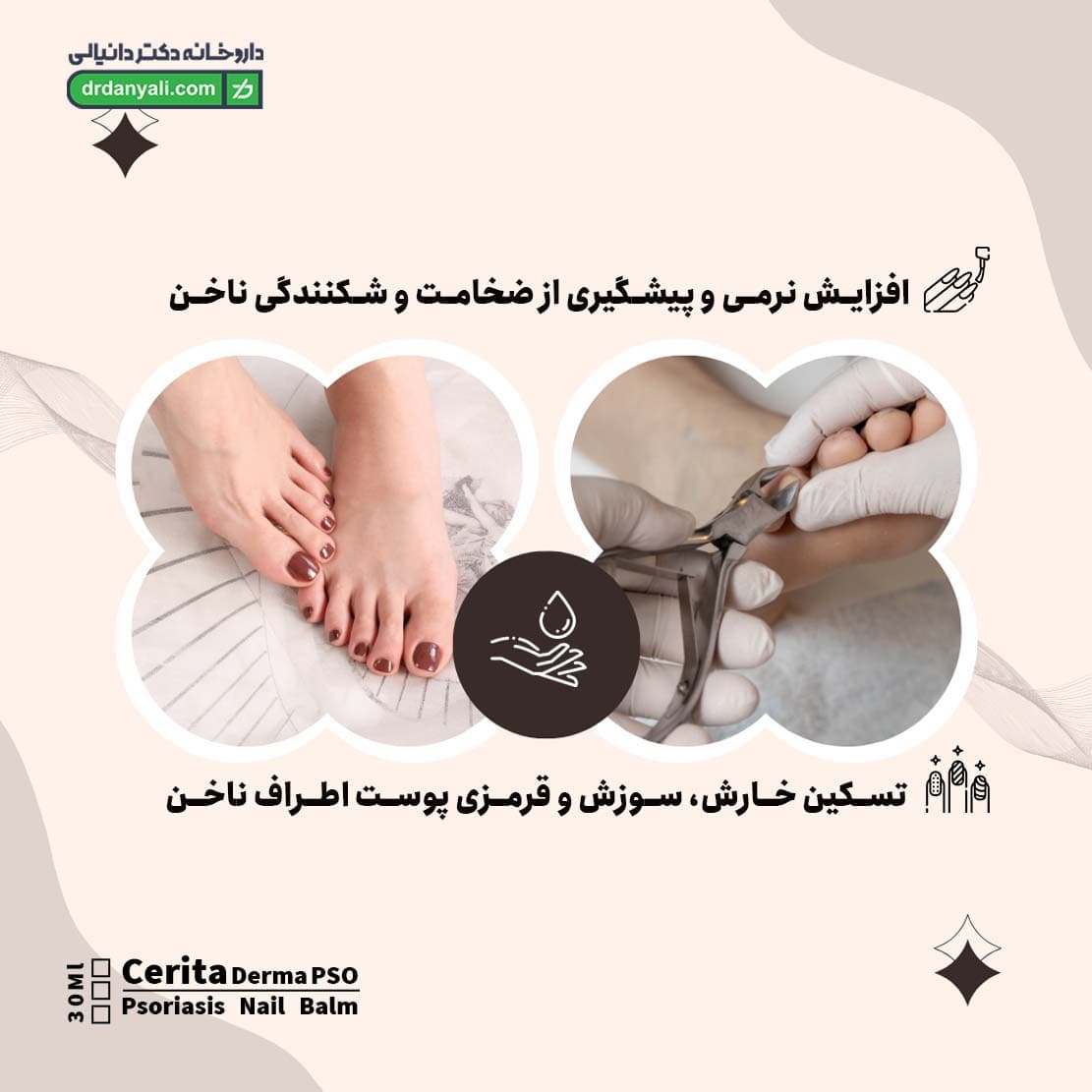 بالم پسوریازیس ناخن سریتا مدل Derma PSO حجم 30 میلی لیتر — تصویر ۸
