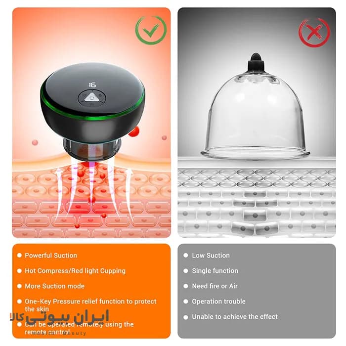 دستگاه بادکش هوشمند کارینا مدل SC05 — تصویر ۹