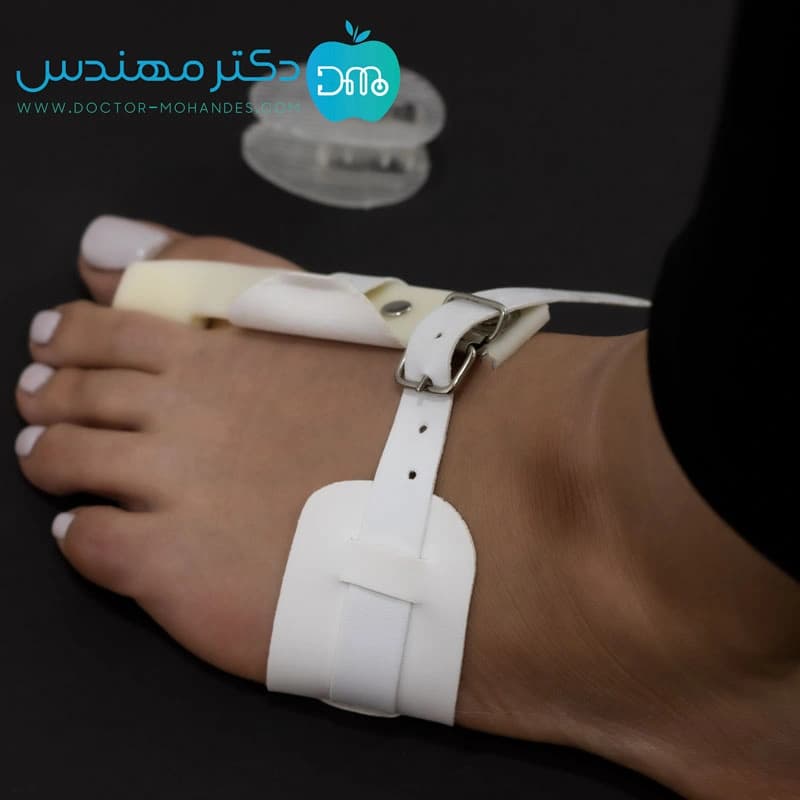 اسپلنت هالوکس والگوس سخت پای چپ پاک سمن کد035