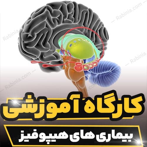 کارگاه آموزشی بیماری های هیپوفیز