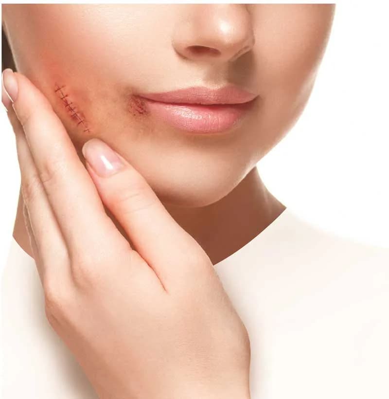 کرم ترمیم کننده زخم ژیناژن حجم 40mL — تصویر ۱۱