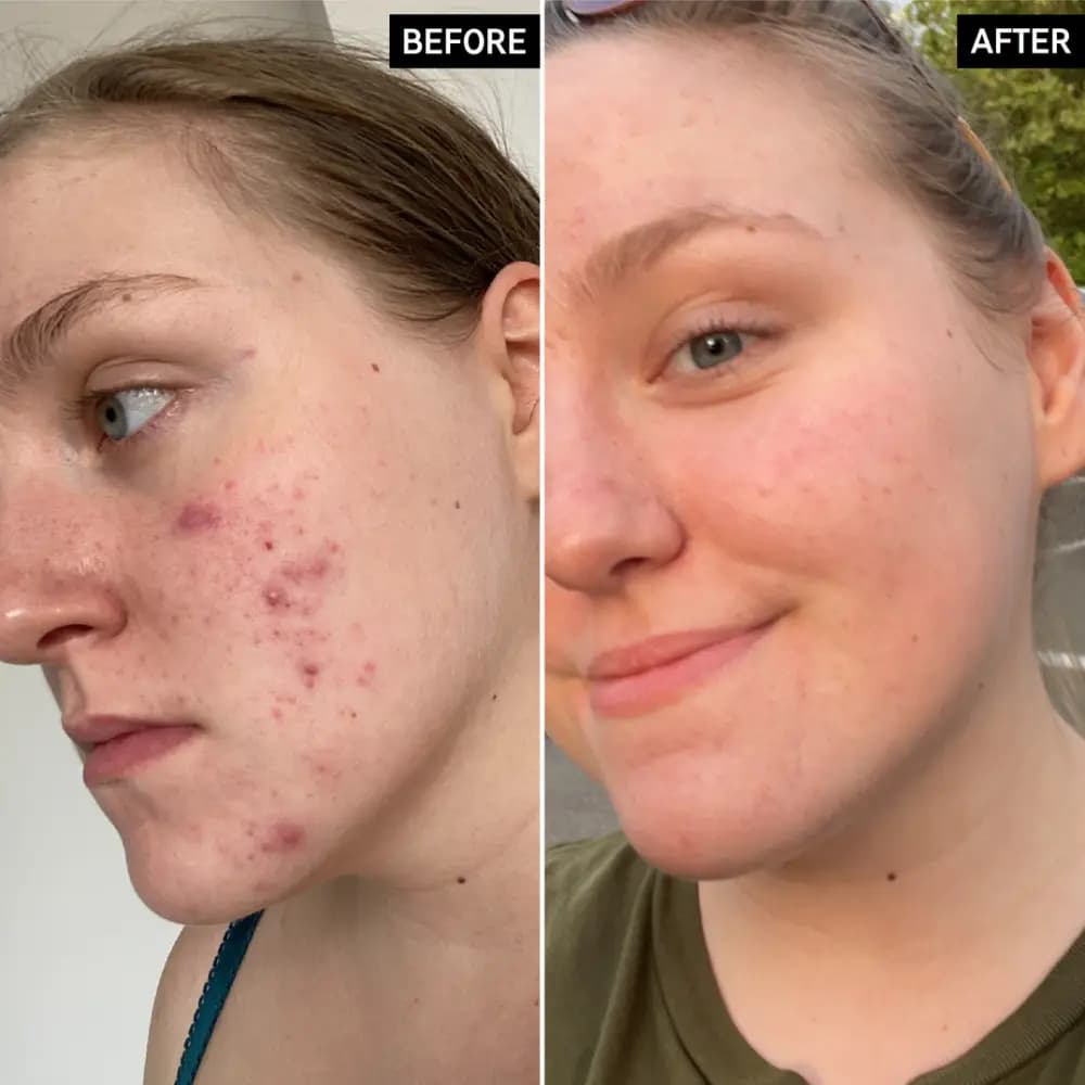 تونر لایه بردار و روشن کننده گلیکولیک اسید اینکی لیست — تصویر ۳